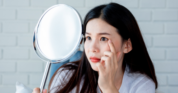 長痘痘是最常見又最令人困擾的現象。（圖／canva）