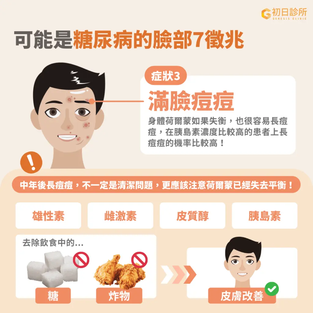 滿臉痘痘可能是血糖失控的警訊之一。 滿臉痘痘可能是血糖失控的警訊之一。