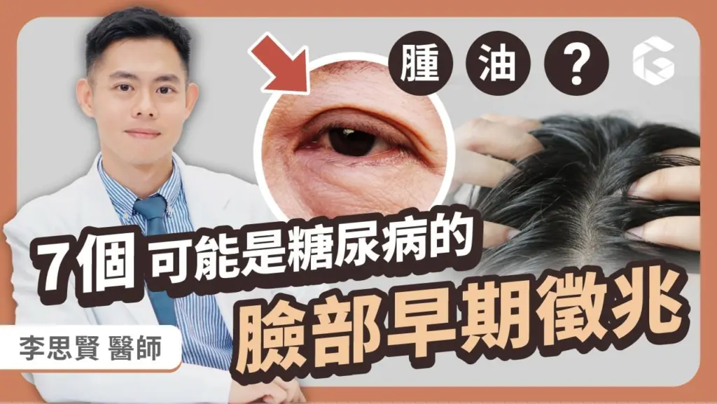 留意臉部 7 個訊號，竟藏著血糖失控的警訊