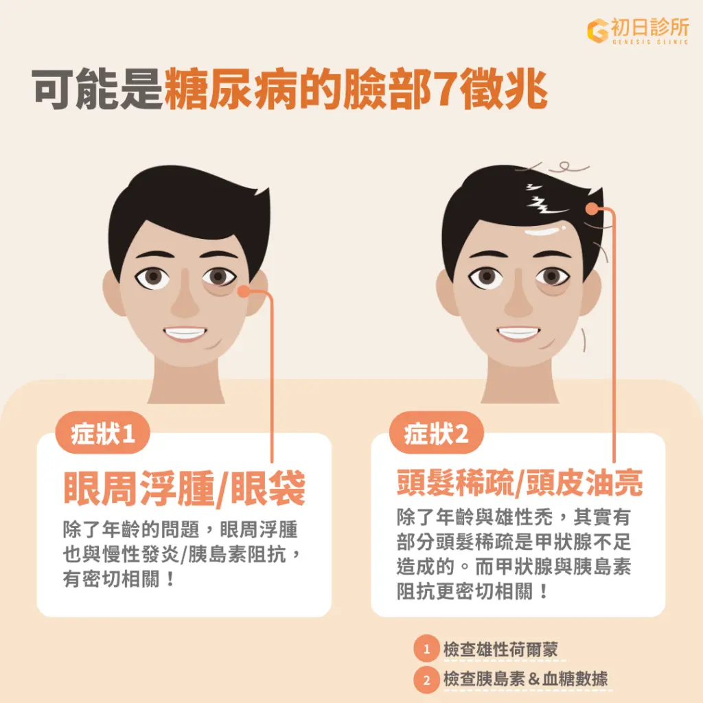 眼週浮腫出現眼袋、頭髮稀疏都可能是血糖失控的警訊。 眼週浮腫出現眼袋、頭髮稀疏都可能是血糖失控的警訊。