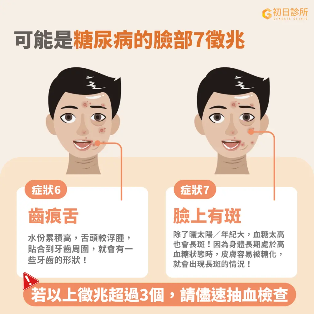齒痕舌、臉上長斑可能都是血糖失控的警訊之一。