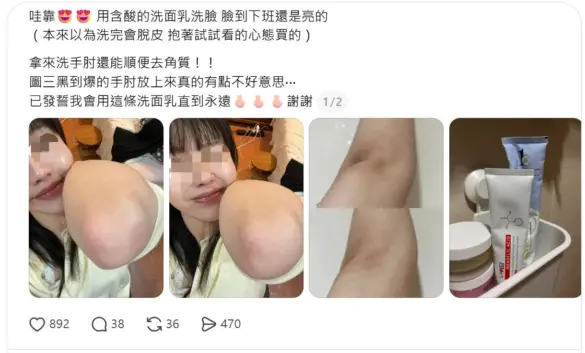 網友在社群分享使用蜜花酸晶拋光洗顏霜的亮臉與去黑手肘對比照。圖 / 擷取自 Threads